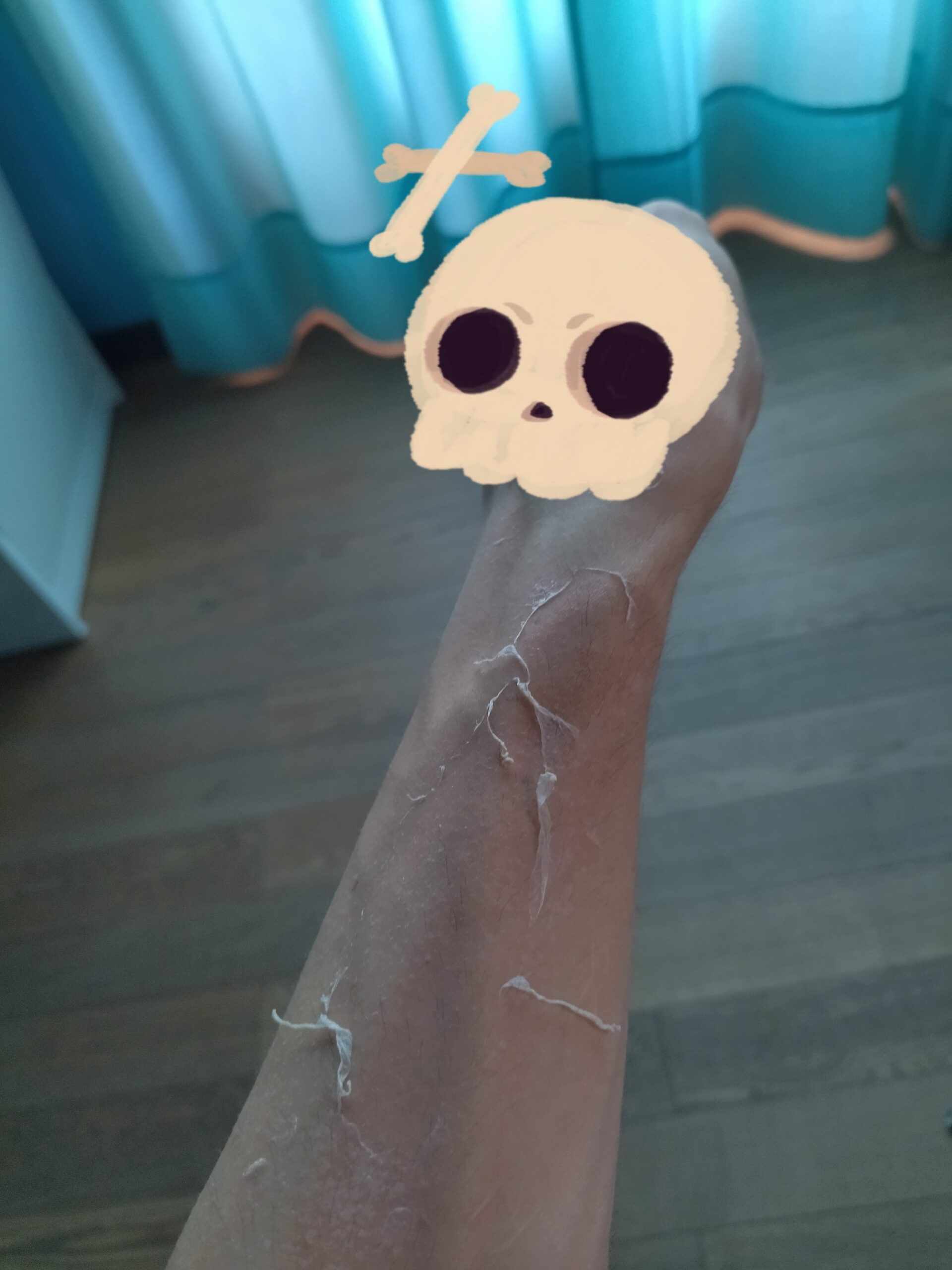 Mio braccio che fa la muta